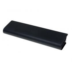 akumulátor pro Dell Typ 0HNCRV 5200mAh__1