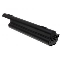 akumulátor pro Dell Typ 312-0774 7800mAh__1