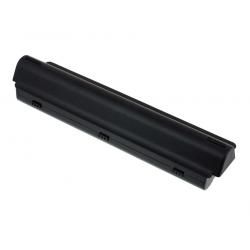 akumulátor pro Dell Typ 312-1123 7800mAh__1