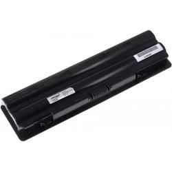 akumulátor pro Dell XPS 14/ XPS15/ XPS17/ Typ 312-1123 5200mAh__3