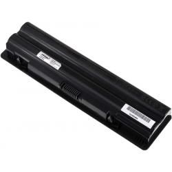 akumulátor pro Dell XPS 14/ XPS15/ XPS17/ Typ 312-1123 5200mAh__4
