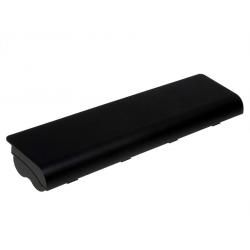 akumulátor pro HP Pavilion dv3-1000 Serie/ Typ HSTNN-IB82 5200mAh__1