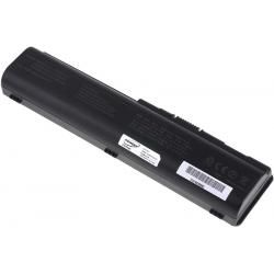 akumulátor pro HP Pavilion dv4z-1000 Serie__4