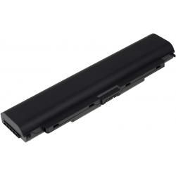 akumulátor pro Lenovo ThinkPad T440p/ T540p, L440, W540/ Typ 45N1145 5200mAh