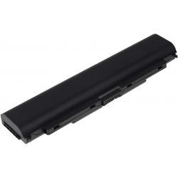 akumulátor pro Lenovo ThinkPad T540P 5200mAh