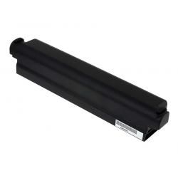 akumulátor pro Toshiba Dynabook Qosmio T451/59DR 9200mAh__1