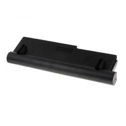 akumulátor pro Toshiba Equium U400-124 7800mAh__1